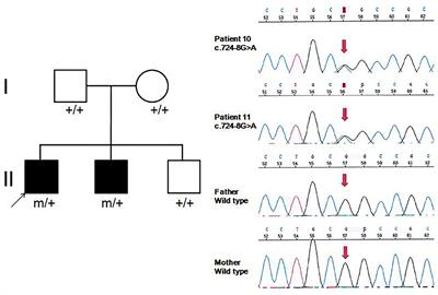 Phenotypes of GNAO1 Variants in a Chinese Cohort